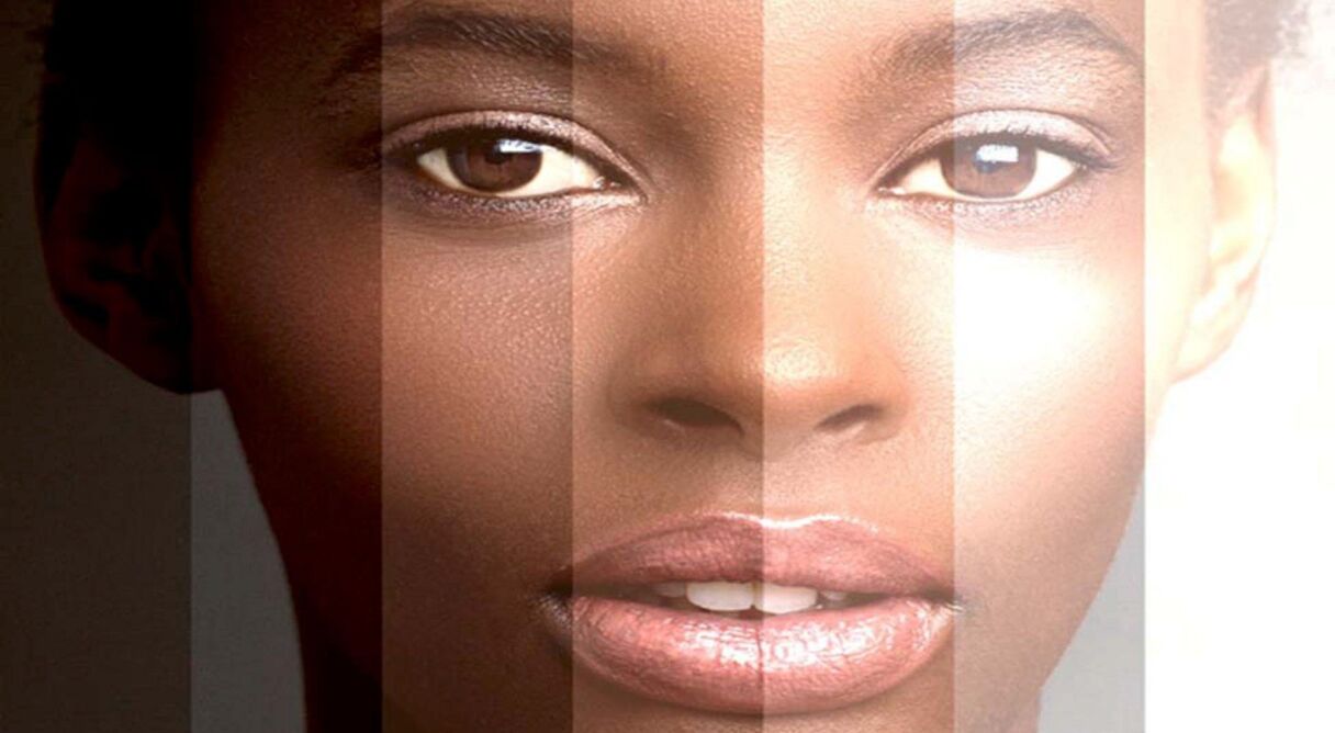 Black Man White Skin