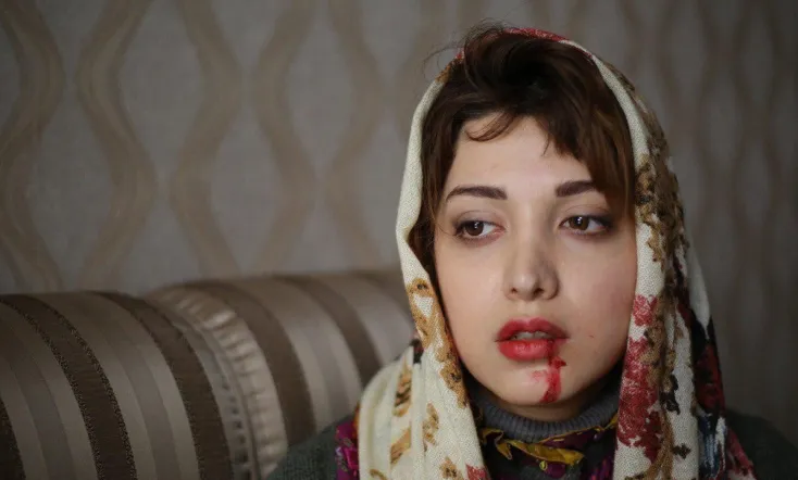 One Kilo and Twenty One Grams