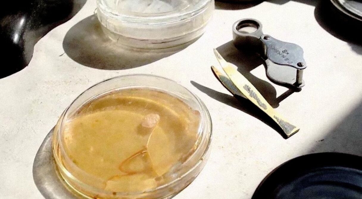 Penicillin: A Medical Revolution