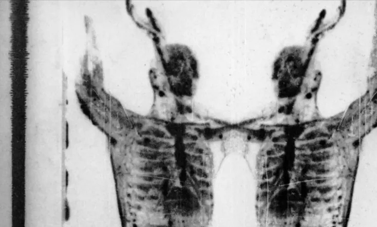 The Radio Wave of Blood Beneath the Dirt Ice and Flowers