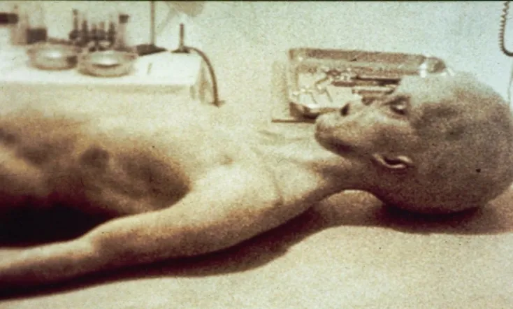 The Alien Autopsy