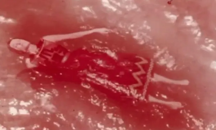 The Dislocation of Amber